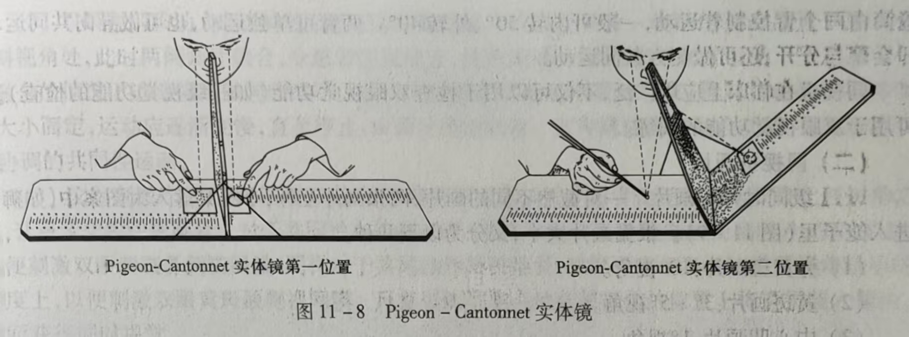 11-8 Pigeon-Cantonnet实体镜.jpg