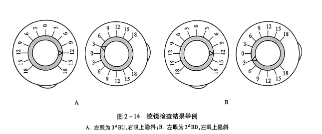 2-14 棱镜检查结果举例.PNG