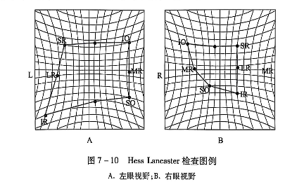 7-10Hess Lancaster检查图例.PNG